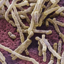 Zinplava (bezlotoxumab): aprobare în UE pentru prevenirea recurenței infecției cu Clostridium difficile